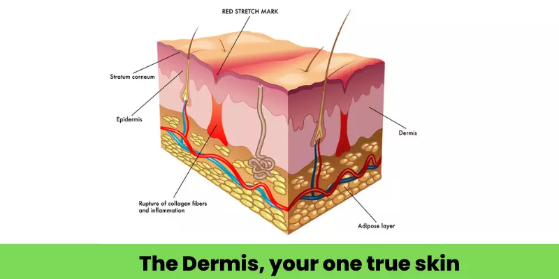 Diagram of the dermis, the living layer of skin, showing the papillary and reticular layers, collagen, blood vessels and glands
