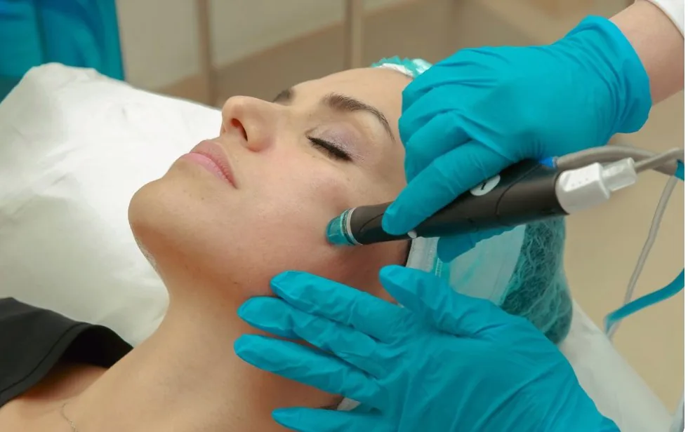 skin reaction after microneedling that ruined my skin