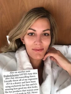 Woman in a white robe with clear, healed skin after recovering from a microneedling treatment